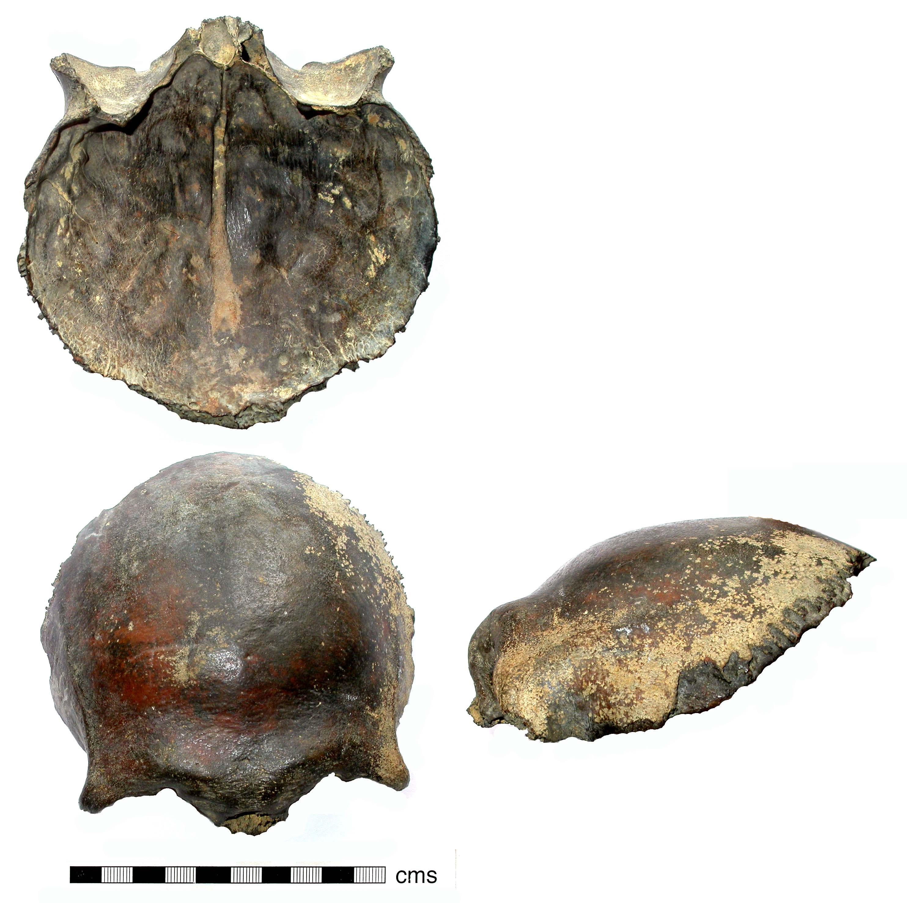 Ancient Genomic History of the Oral Pathogen Streptococcus mutans Over 8,000 Years