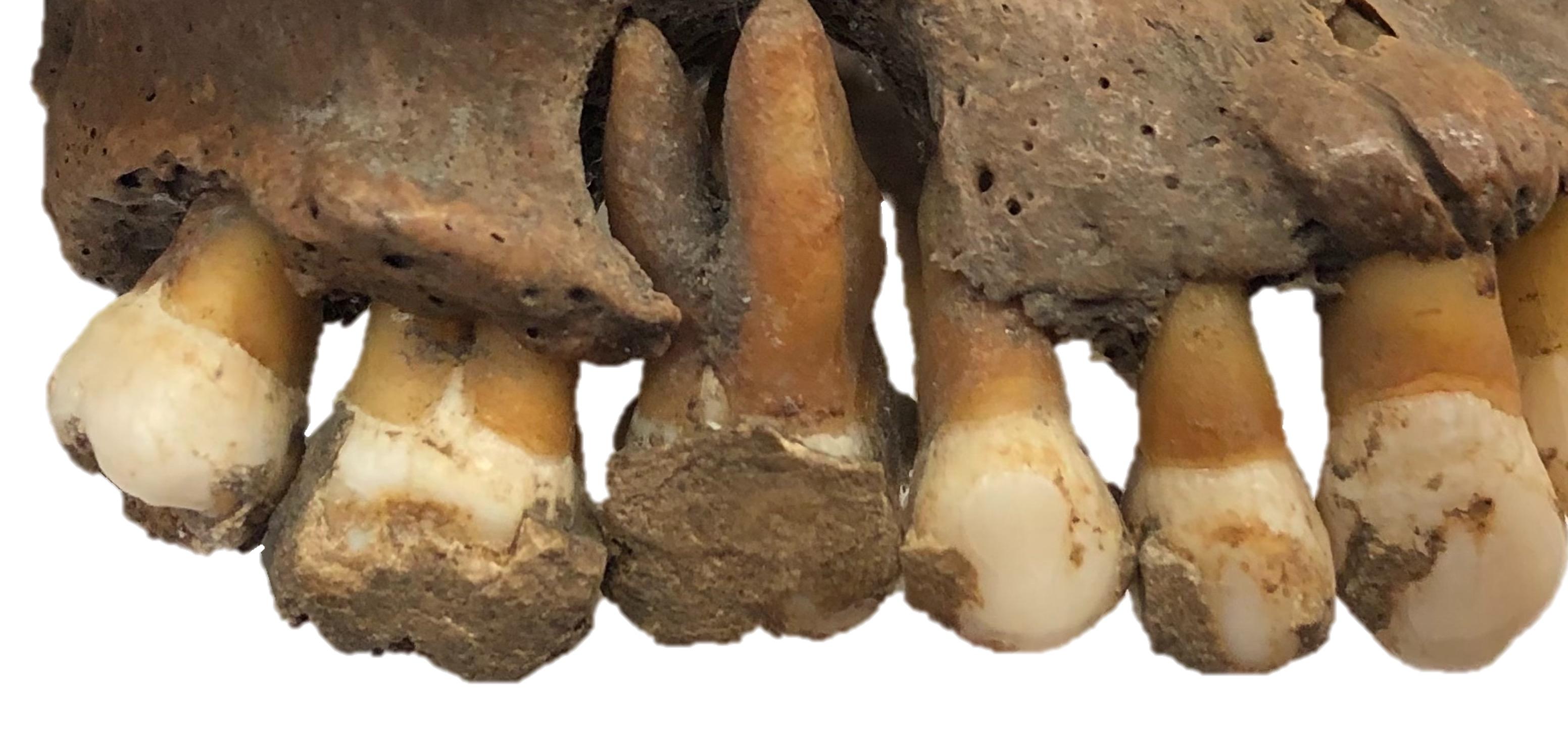Ancient Oral Microbiome Database: A 102,000‑Year Relational Record of Dental Calculus DNA