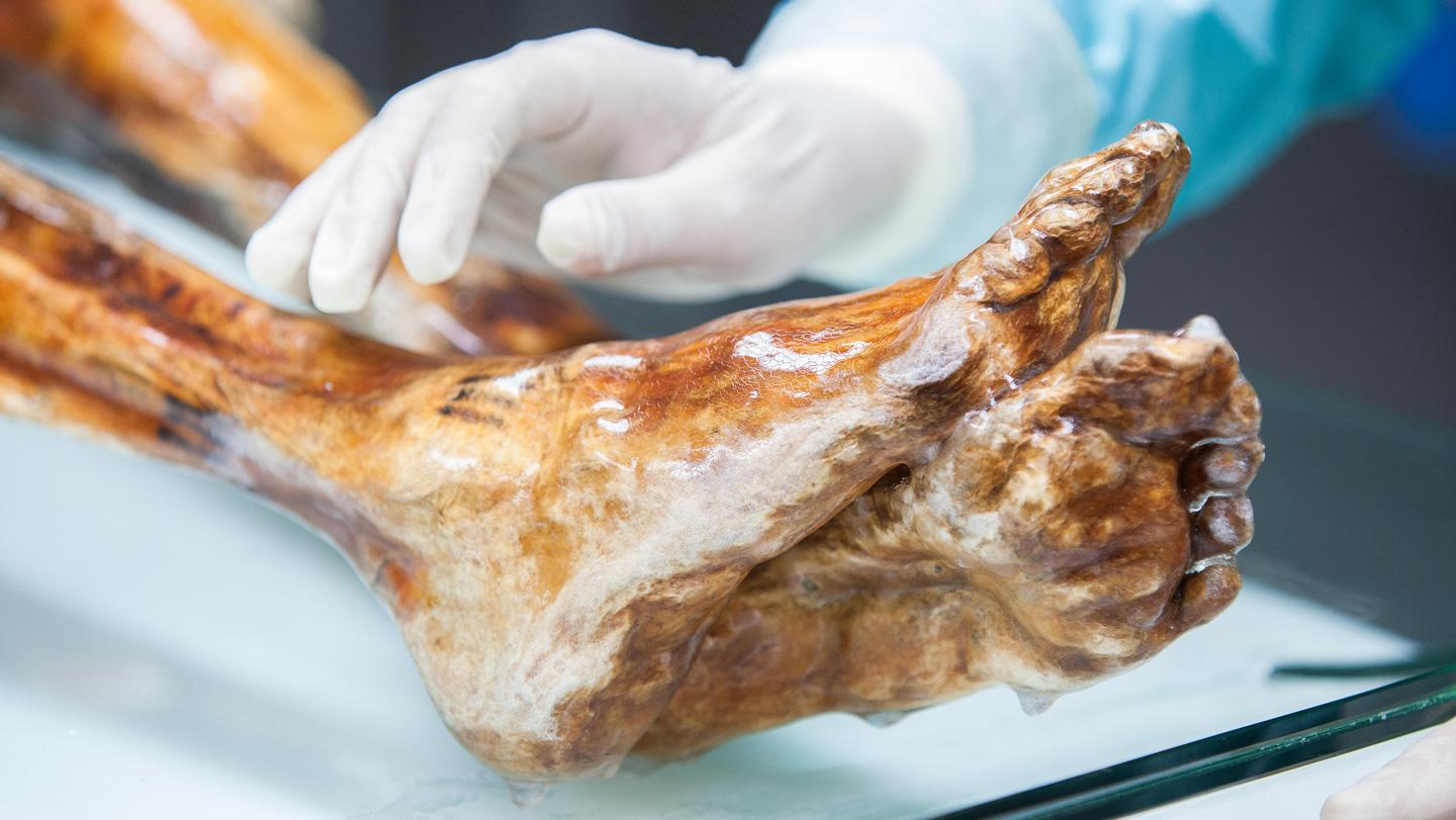 Ancient and Modern Microbes on Ötzi: The Dynamic Microbiome and Conservation Risks of the Iceman