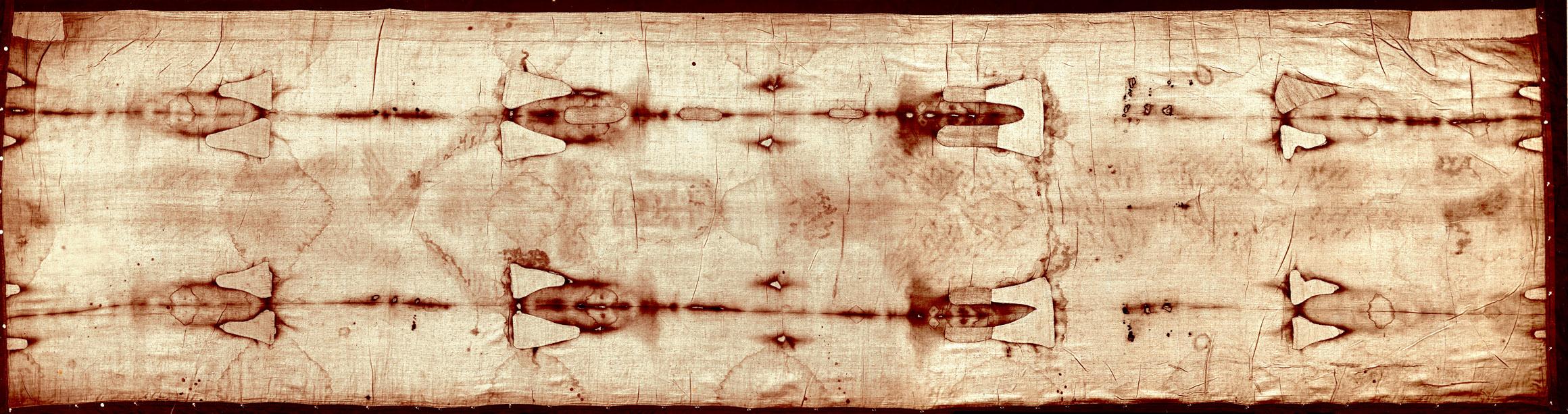 DNA and Contamination Analysis of the Turin Shroud Samples